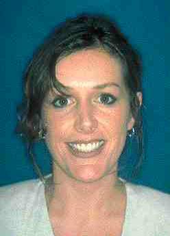 FIGURE 10 After: Complete case with facial transformation.