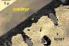 FIGURE 6 TEM of One-Step (BISCO) on acid conditioned dentin using the wet bonding technique (dentin surface left moist prior to primer application). The primer has completely penetrated the demineralized dentin forming the hybrid layer (H). TEM courtesy of Dr. Franklin Tay.