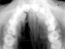 1000107541-1000238759 alternate text for this image