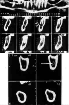 FIGURE 6 CT images