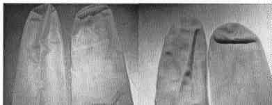 FIGURE 1: Stained PVC (left) and Nitrile rubber (right) gloves by Birex (phenol-based) solution. For comparison purposes the unstained glove is shown on the right in both pictures.