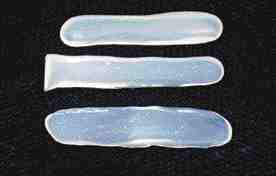 FIGURE 18 Herculite XRV incisal: Note the variable translucency and halo.