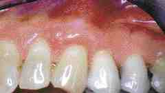 1000107400-1000244376 alternate text for this image