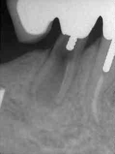 FIGURE 7 Part of figure 3.