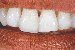 1000127662-1000262435 alternate text for this image