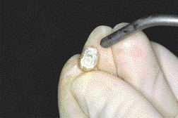 FIGURE 11--Temporary cement trick for no high spots and minimal cleanup.