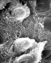 FIGURE 5B--SEM base of resin composite cylinder, note resin tags and attached collagen mesh (x10.0K).