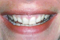 1000176161-1000260045 alternate text for this image