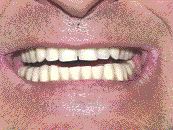 FIGURE 12--Completed case.