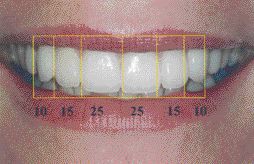 FIGURE 15B - Treated case with more pleasing result having more ideal Golden Percentages.