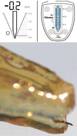 FIGURE 8C--When the file glide path is extended into a negative reading on the display, the file was out of the canal in all cases.
