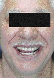 FIGURE 24--Smile