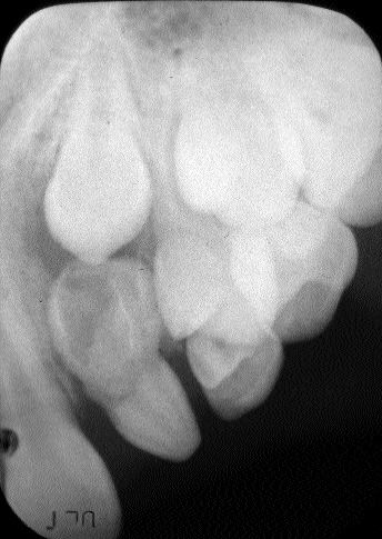 1000194597-1000272441 alternate text for this image