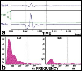 FIGURE 3--A) Time domain; B) Frequency domain.