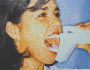 FIGURE 20--Therabite: An active physiotherapy device commonly utilized by patients to enhance and/or maintain mandibular range of motion following surgery.