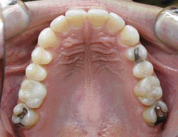 1000198787-1000284748 alternate text for this image