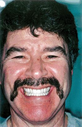 FIGURE 27--Happy patient!