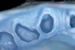 FIGURE 25--Close up of impression detail.