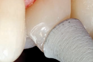 1000226355-1000317746 alternate text for this image