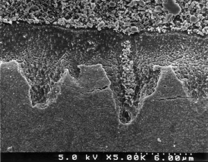 FIGURE 4--Hybrid layer formed by a one-bottle adhesive, PQ1 (Ultradent).