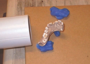 FIGURE 1--31, 41 and 42 are seashell implants. Mandible positioned for x-ray examination.