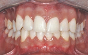 FIGURE 7--Post treatment result.