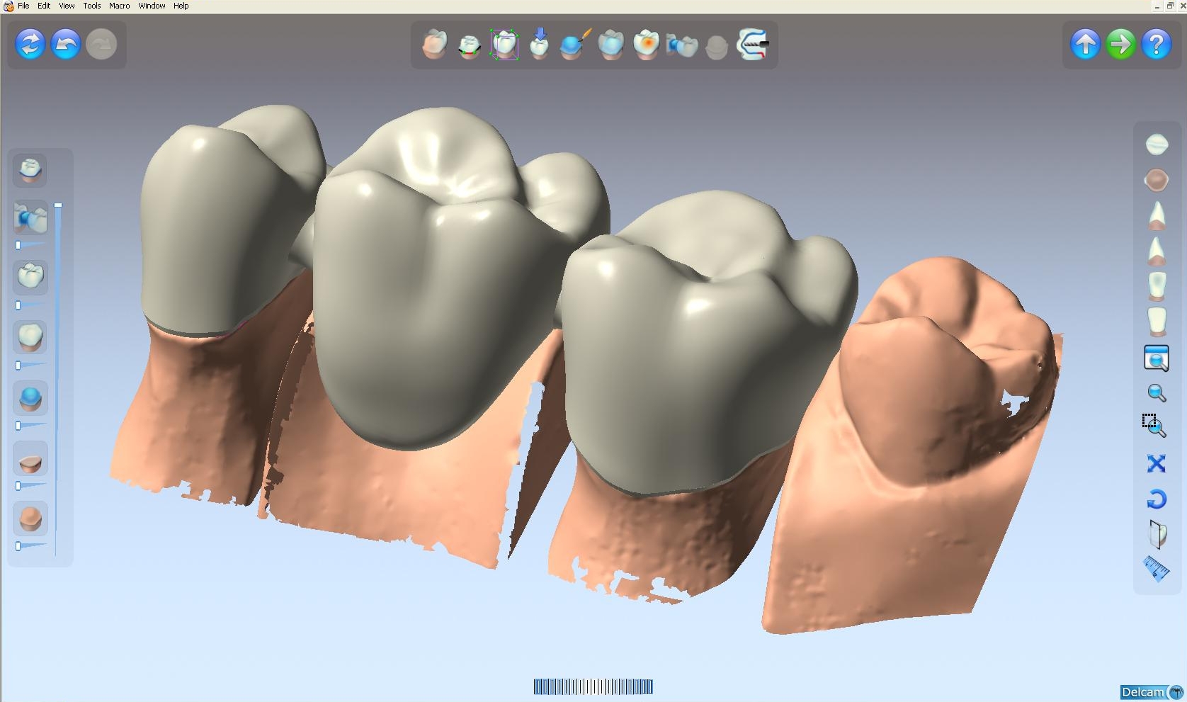 DentCAD