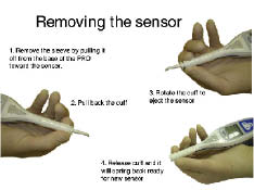 Figure 12--When the assessment is complete there is a quick, safe and easy method for removal of the used sensor.
