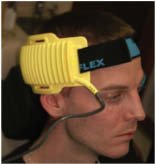 Figure 22-Temporalis Muscle.