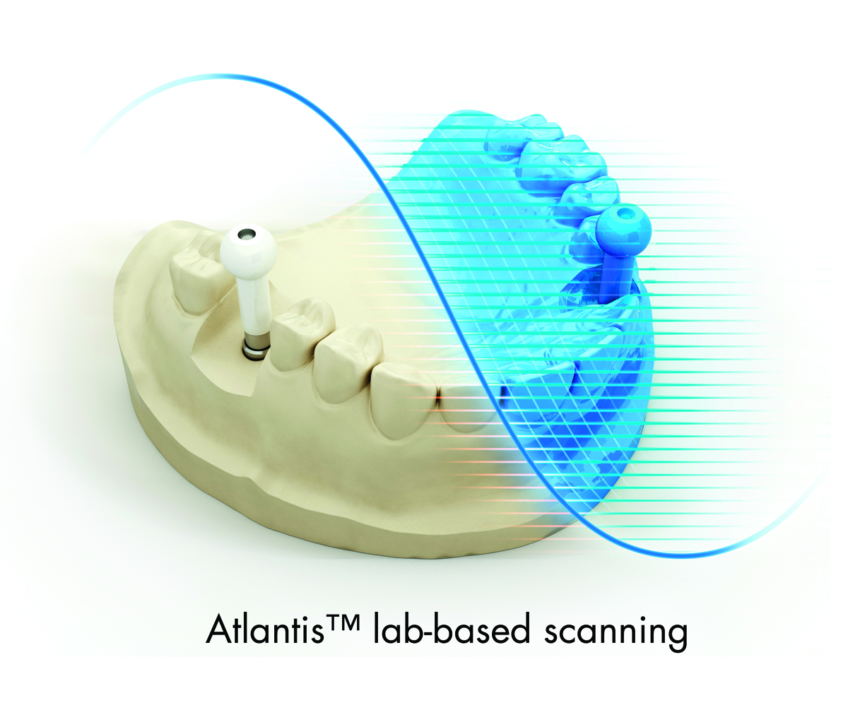 Atlantis_lab-based scanning