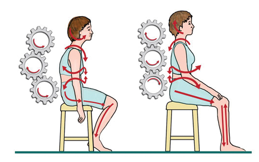 Figure 1. The common dental posture, and the "cog and wheel" effect contributed by our thoracic spine and the subsequent changes in the body leading to long-standing injury.