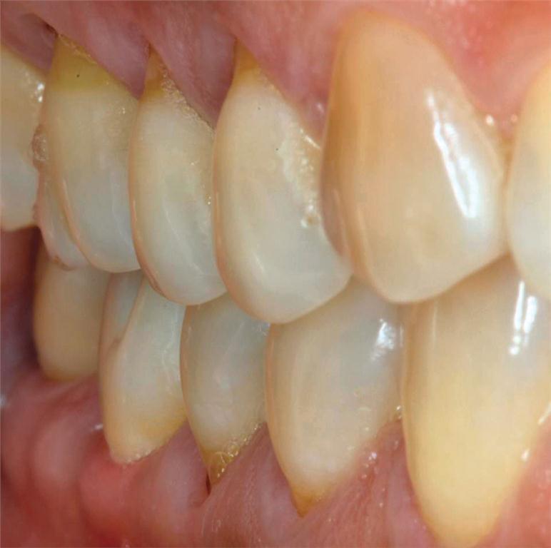 Figure 21. Beautiful soft tissue profile