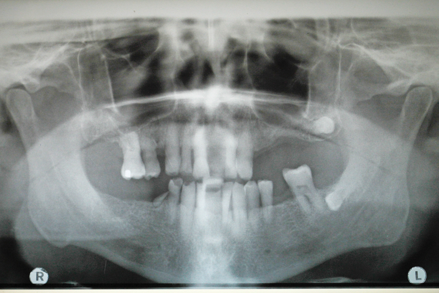 201511091249364f1ke0gmg45kpxtbiflq2j045 alternate text for this image