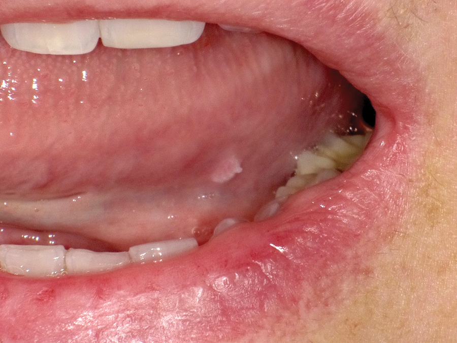 SHOFU DENTAL DIGITAL CAMERA alternate text for this image