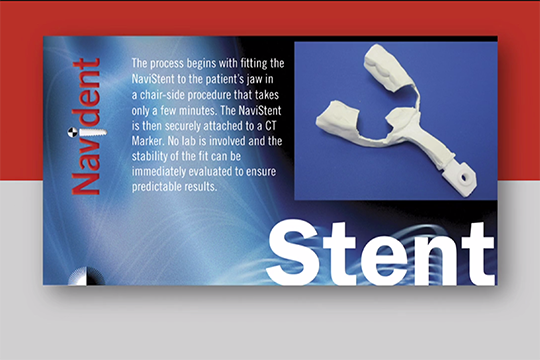 Claronav Navident Thumbnail ASM alternate text for this image