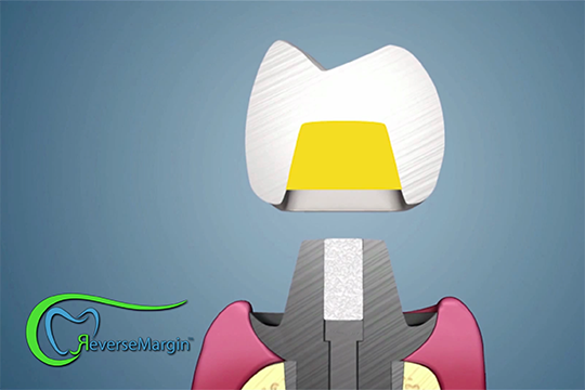 Reverse Margins Thumbnail ASM alternate text for this image