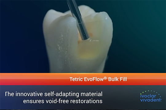 ivolcar-thumbnail-jdiq alternate text for this image