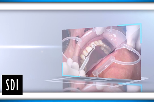 SDI Thumbnail JDIQ alternate text for this image