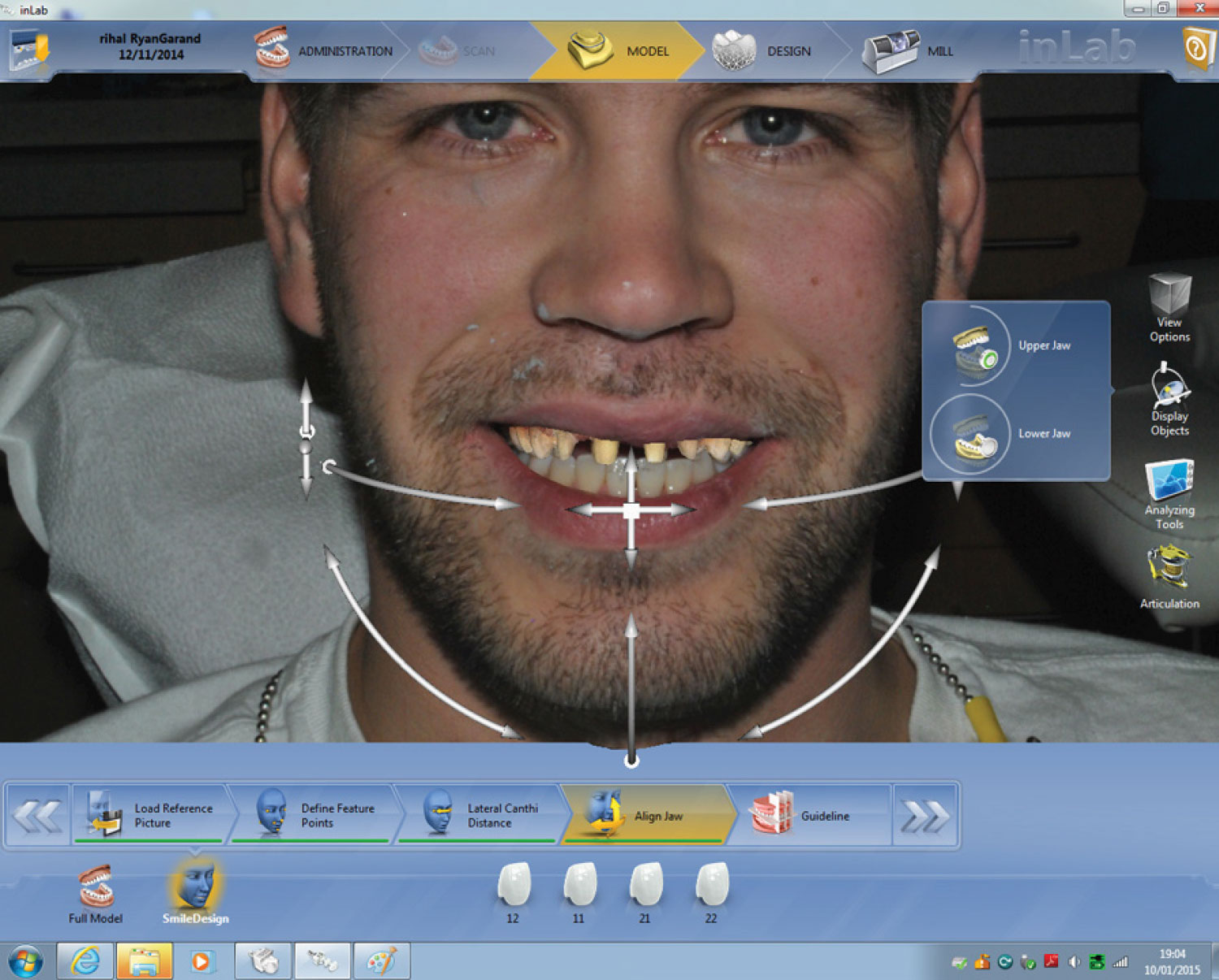 Digital Smile Design