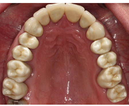 winnett-figure-8 alternate text for this image