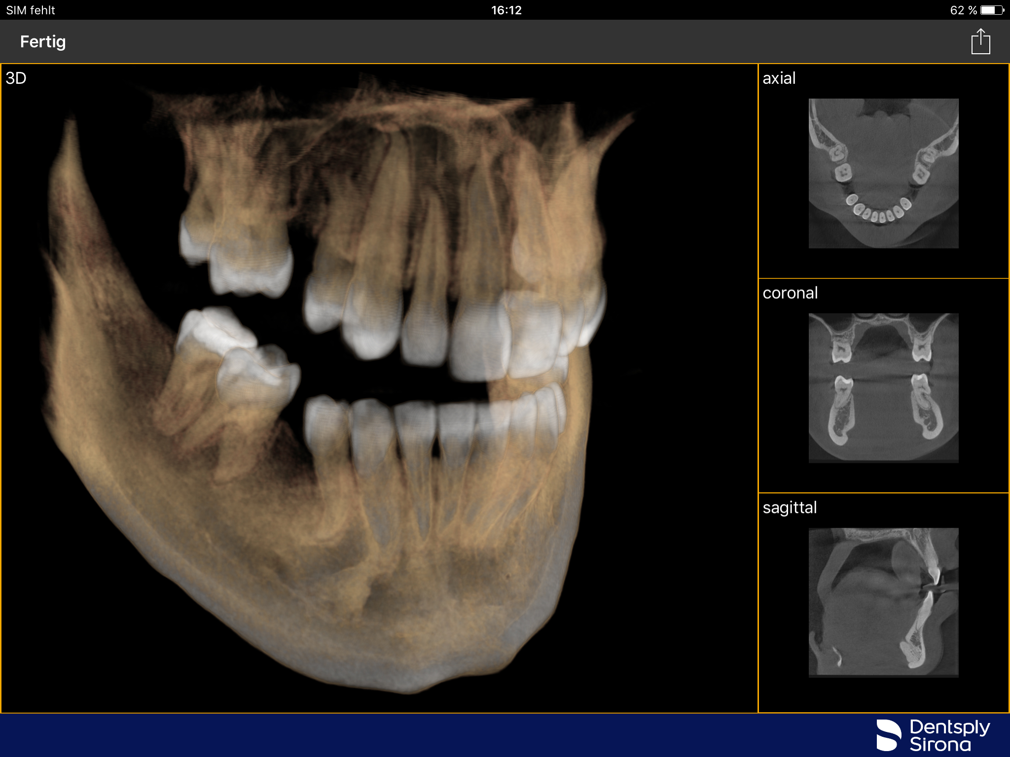 Sidexis_iX_Version_4.0-1 alternate text for this image