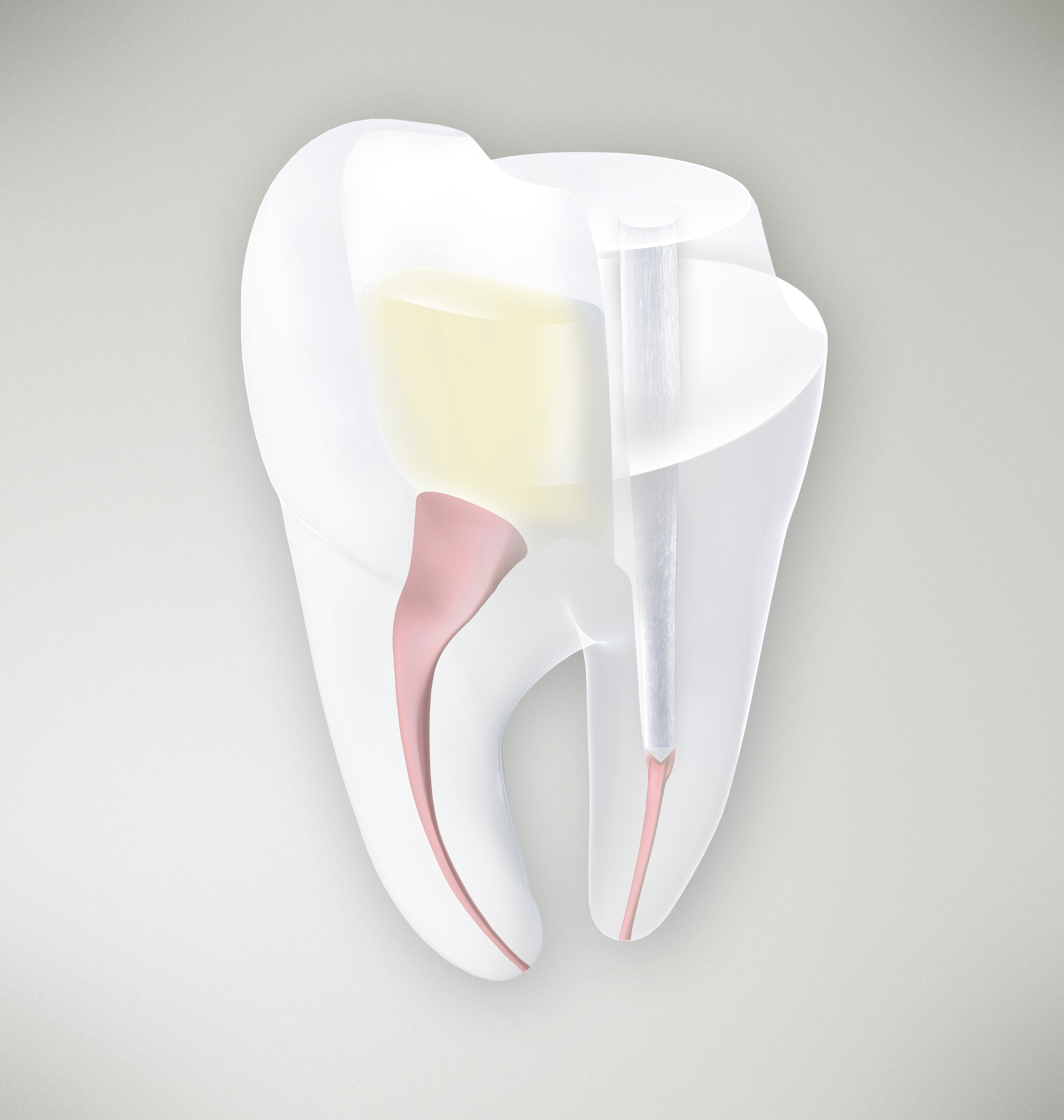 Dentsply-Sirona-R2C alternate text for this image