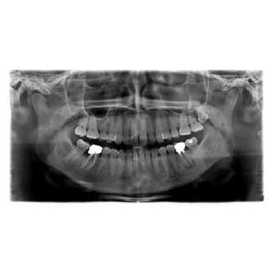 deental-intro alternate text for this image