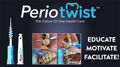 periotwist alternate text for this image