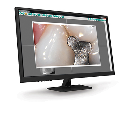 DX4HD_Clinical_Monitor_web alternate text for this image