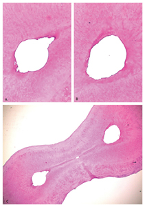 Two Different Shaping Systems
