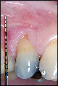 Benjamin fig 1 alternate text for this image