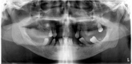 Davis pan1 alternate text for this image