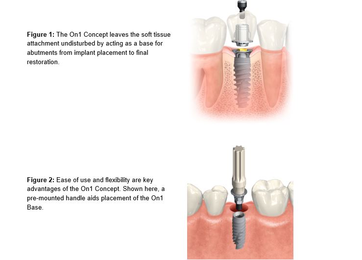 On1-images alternate text for this image