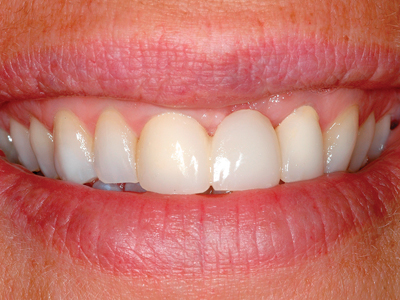 Arlin 5A alternate text for this image